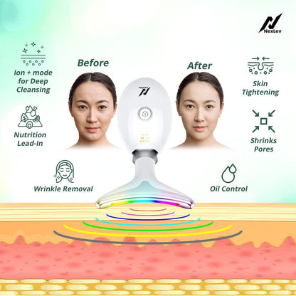 Nexlev Skin Lift Device (LE-04) | 7 Color LED | Face & Neck Skin Lifting| 3 Massage Modes